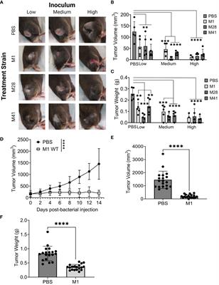 Group A streptococcal collagen-like protein 1 restricts tumor growth in murine pancreatic adenocarcinoma and inhibits cancer-promoting neutrophil extracellular traps